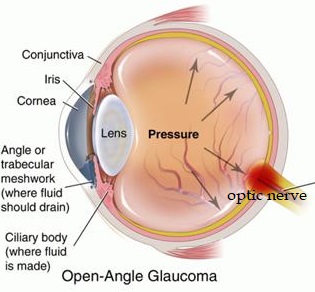 eyecare,vision ophthalmologist